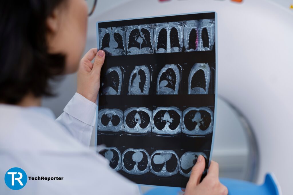 استفاده از <yoastmark class=